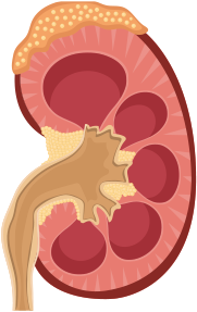 Cross section of a kidney